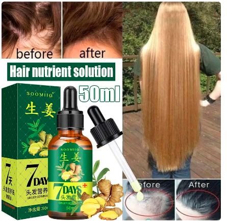 Ginger Hair Growth Spray Serum For Anti Hair Loss Essential Oil Products Fast Treatment Prevent Hair Thinning Dry Frizzy Repair - Amado Deals - wholesale and distributors with free shipping in United States Ginger Hair Growth Spray Serum For Anti Hair Loss Essential Oil Products Fast Treatment Prevent Hair Thinning Dry Frizzy Repair - Amado Deals - wholesale and distributors with free shipping in United States